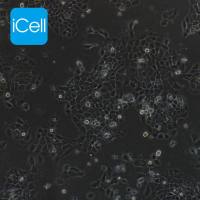 A431 |A431细胞|A-431|A-431细胞|A-431人表皮癌细胞/STR鉴定/镜像绮点