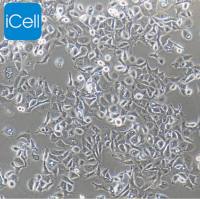 SW-780人膀胱移行细胞癌/SW780细胞/SW780/SW-780/SW-780细胞/STR鉴定/镜像绮点（Cellverse）