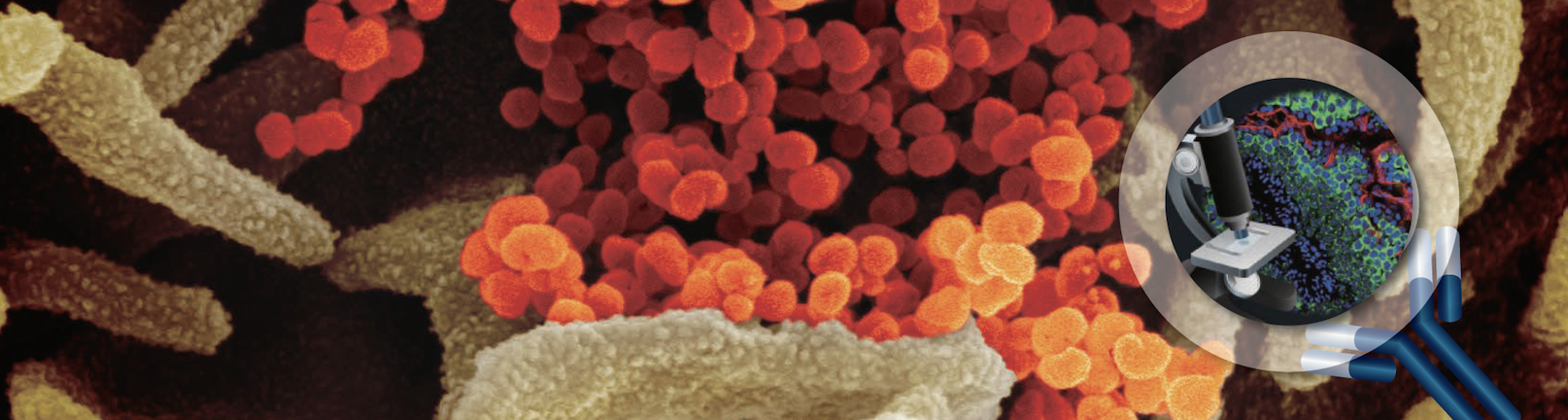 促销！购买 CST 7 大疾病相关信号通路抗体，洞悉疾病机制，领取免费*精美礼品！