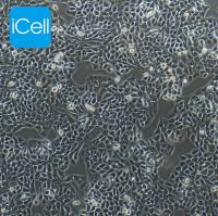 HT29  人结肠癌细胞|HT-29|HT-29细胞|HT29|HT29细胞|STR鉴定/镜像绮点