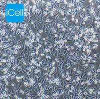 A375-EGFP人恶性黑色素瘤细胞/STR鉴定