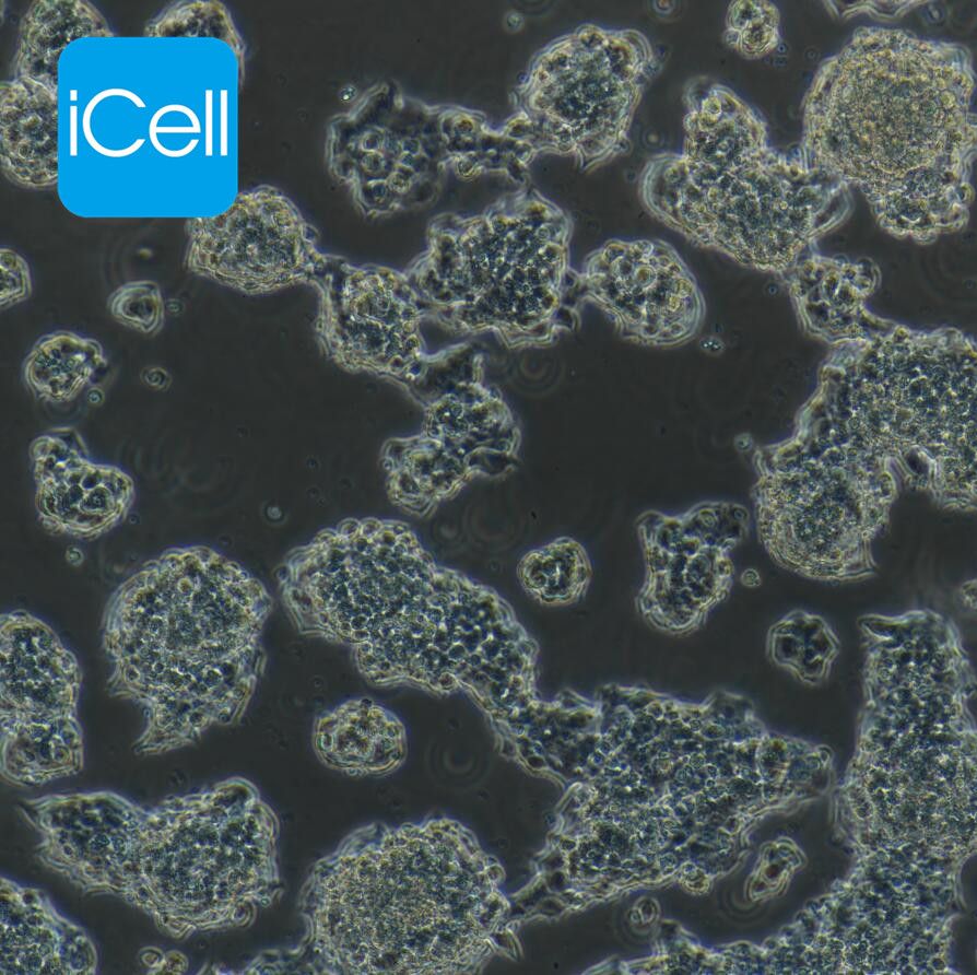 Beta-TC-6 小鼠胰腺癌beta细胞/STR鉴定/镜像绮点（Cellverse）