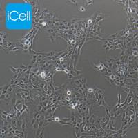 LX-2 人肝星形细胞/LX-2/LX-2细胞/LX2/LX2细胞/STR鉴定