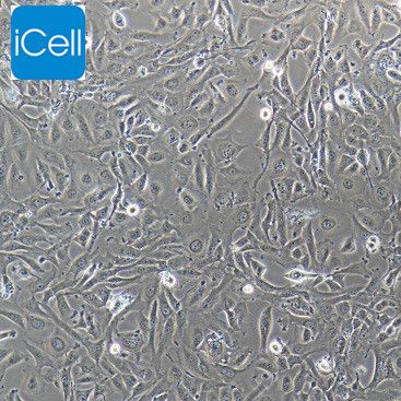 J82 人膀胱移行细胞癌/STR鉴定/镜像绮点（Cellverse）