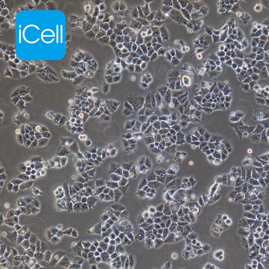 Caov-3 人卵巢腺癌细胞/STR鉴定/镜像绮点（Cellverse）