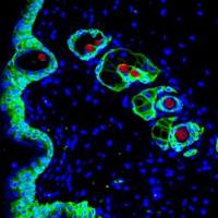 石蜡冰冻切片TUNEL凋亡荧光