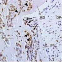 石蜡冰冻切片TUNEL凋亡