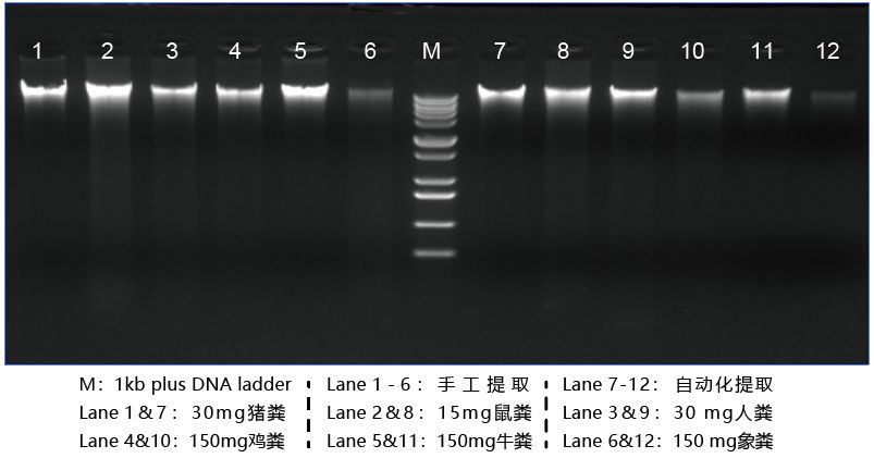说说粪便 DNA 提取在结直肠癌研究中的应用