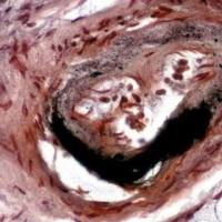 Masson三色染色实验服务