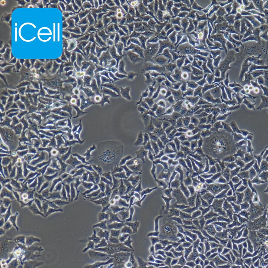 HO-8910PM 人高转移卵巢癌细胞/STR鉴定