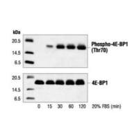 蛋白质免疫印迹法 (Western Blot ) 实验服务