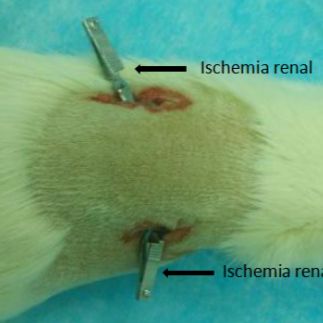 肾缺血再灌注损伤(RIRI)大鼠模型