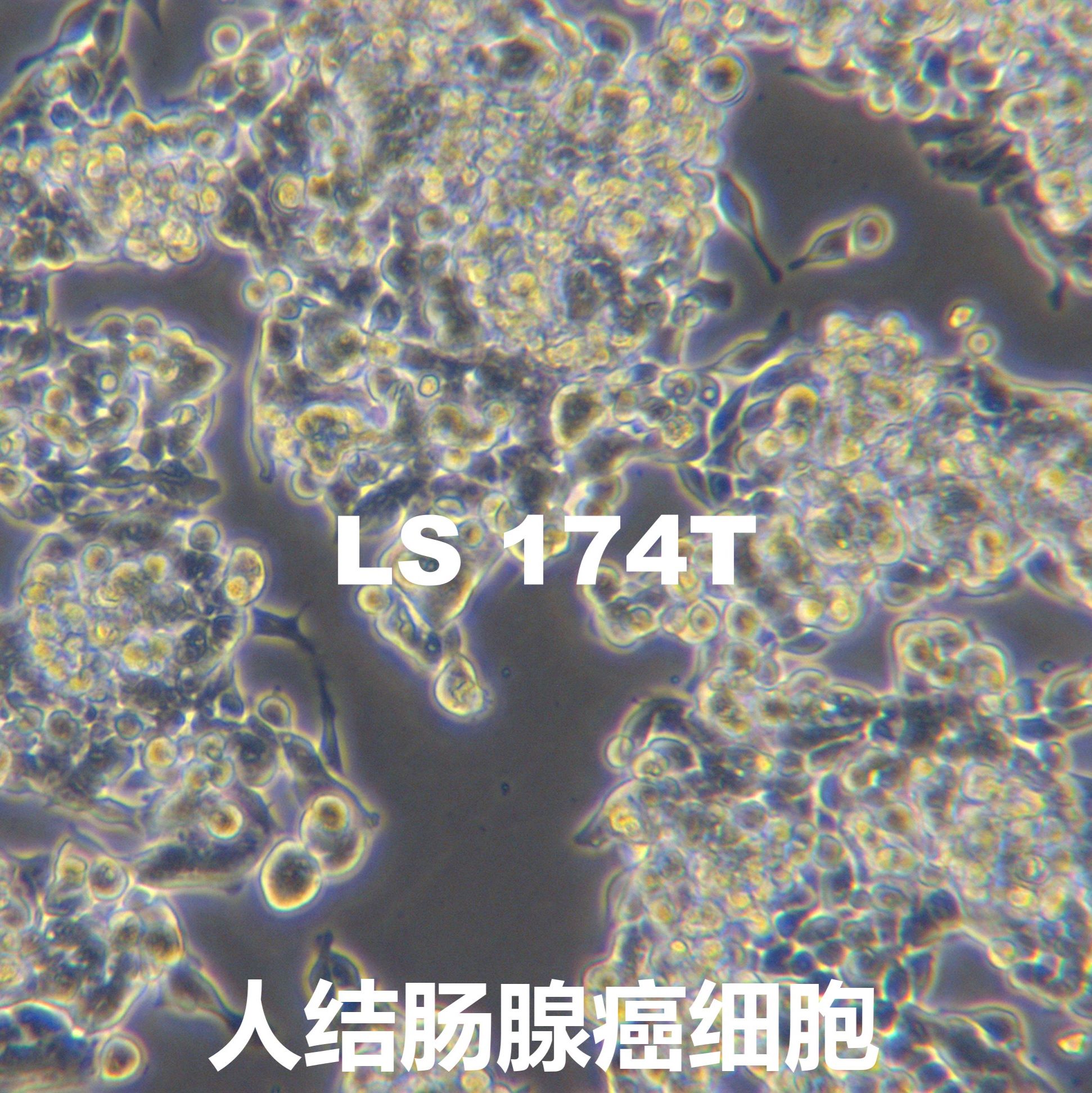 LS 174T[Ls174T; LS174t; Ls-174-T; LS-174-T]人结肠腺癌细胞