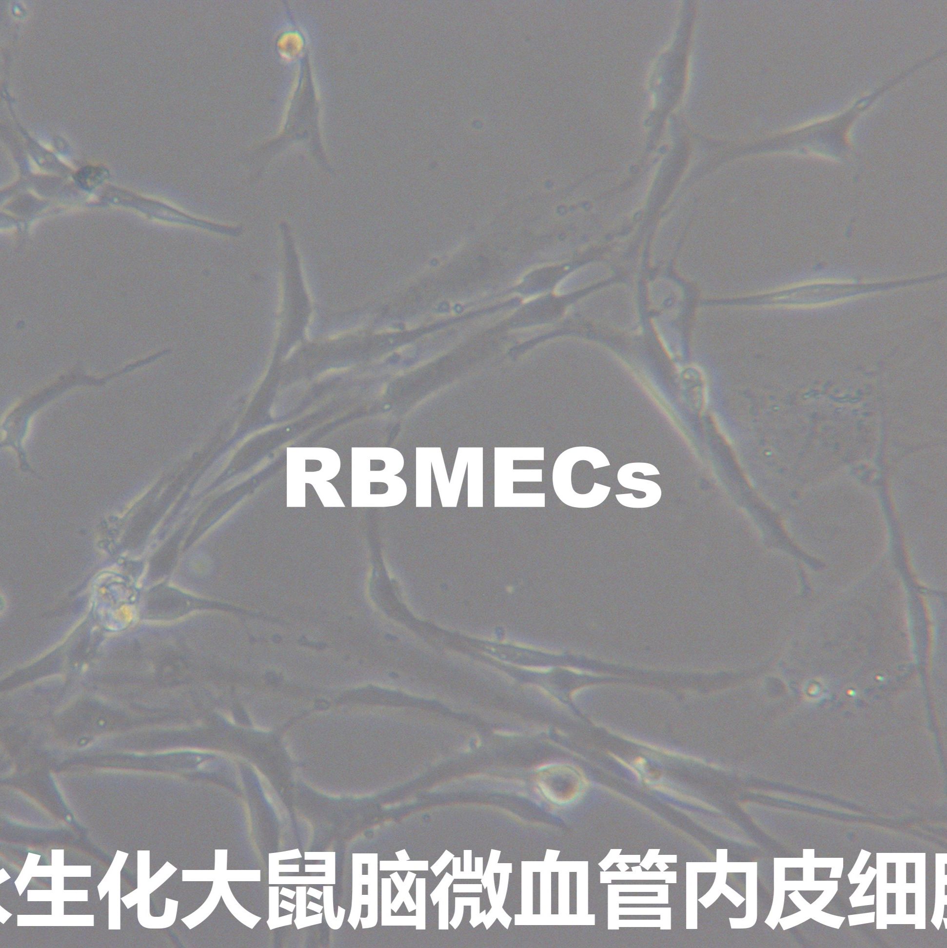 RBMECs永生化大鼠脑微血管内皮细胞