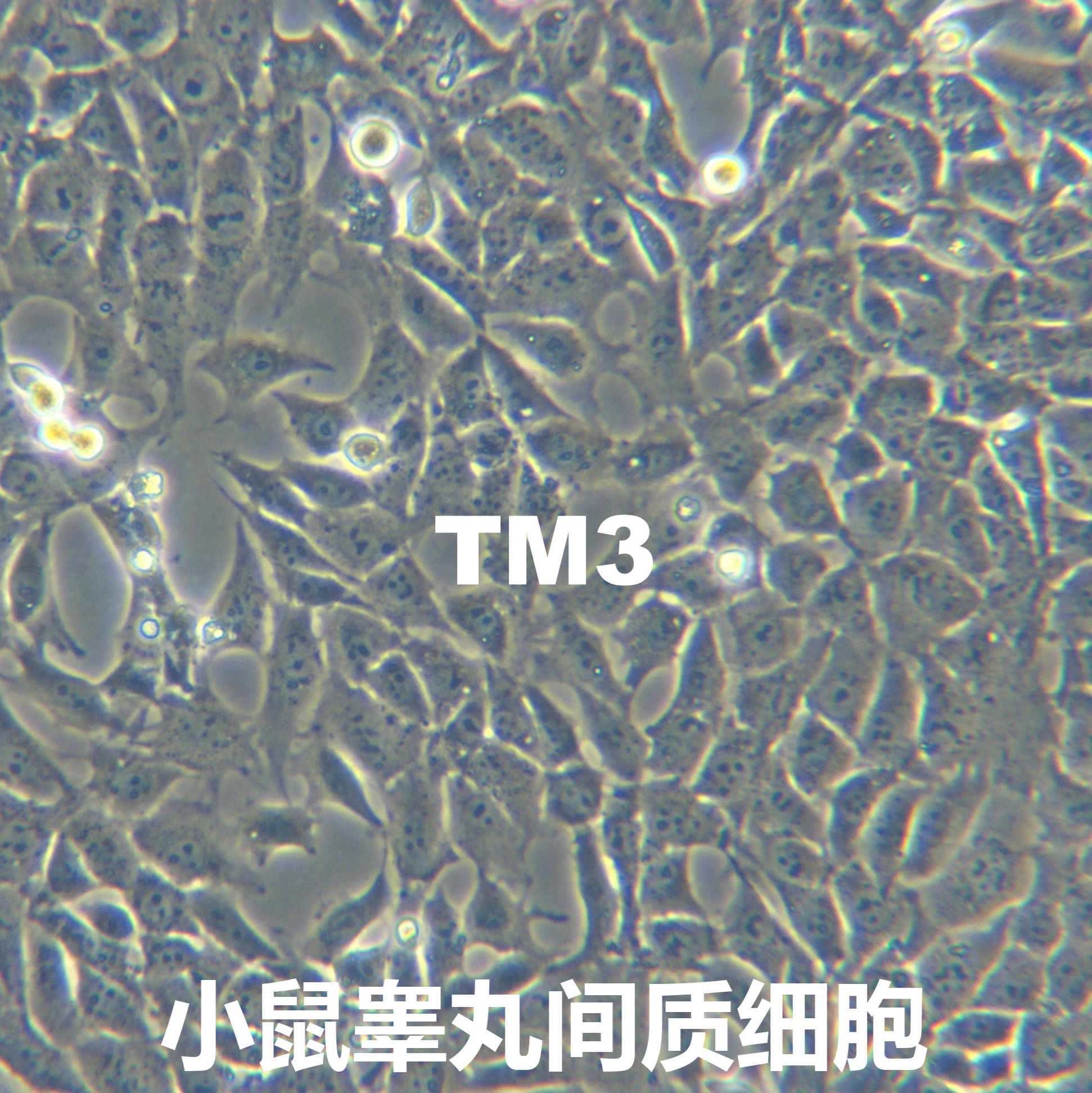 TM3【TM-3】小鼠睾丸间质细胞