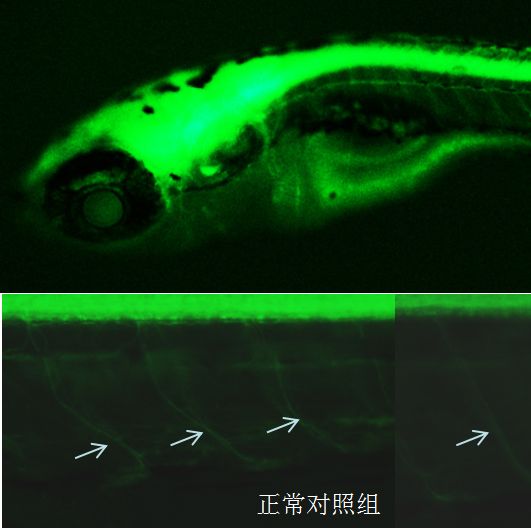 利用斑马鱼模型评价糖尿病神经保护功效