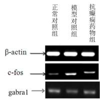 利用斑马鱼模型评价抗癫痫作用