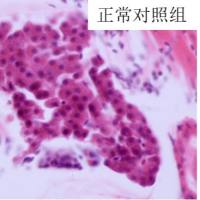 利用斑马鱼模型评价保护肝脏作用