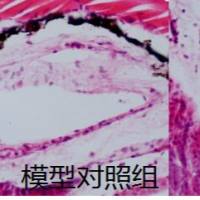 利用斑马鱼模型评价病毒性肺炎防治作用