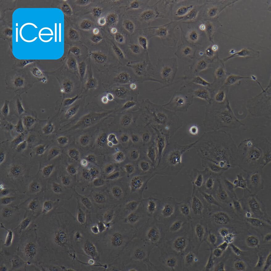 HUVEC-C 人脐静脉内皮细胞/STR鉴定/镜像绮点（Cellverse）