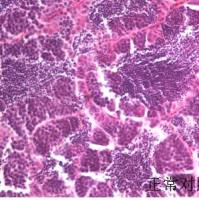 利用斑马鱼模型评价致癌性风险