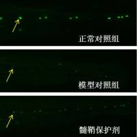 利用斑马鱼模型评价多发性硬化症