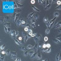 MDA-MB-231 人乳腺癌细胞/MDA-MB-231/MDA-MB-231细胞/STR鉴定