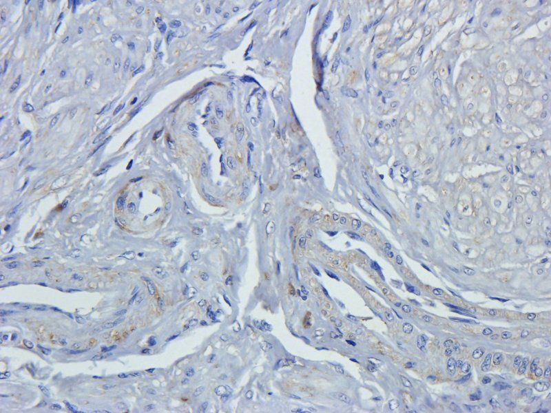 Ly-6G antibody抗体，biorbyt，orb32