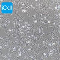 Calu-1细胞 | Calu1细胞 | Calu-1 | Calu1 | Calu1人