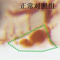 利用斑马鱼模型评价抗血小板聚集性血栓作用