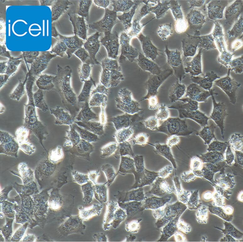 MuM-2B 人侵袭性脉络膜黑色素瘤细胞/STR鉴定/赛百慷（iCell） 