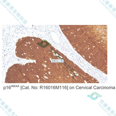 p16(MM116)鼠单克隆抗体