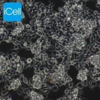 LS174T 人结直肠腺癌细胞/STR鉴定/镜像绮点(Cellverse)