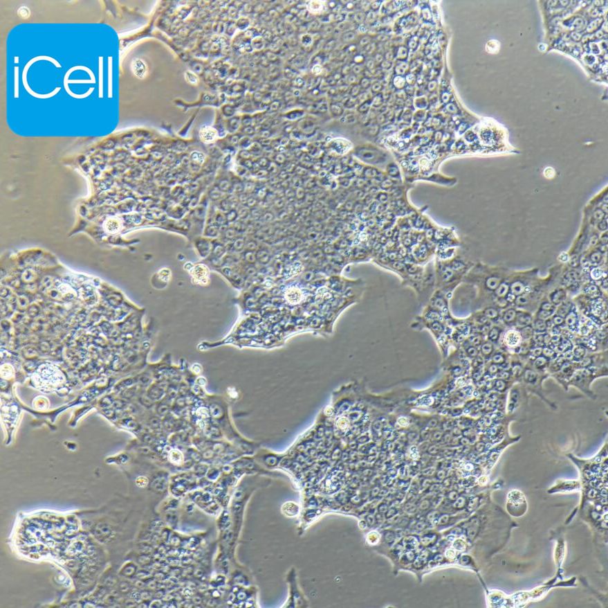 Capan-1 人胰腺癌细胞/STR鉴定