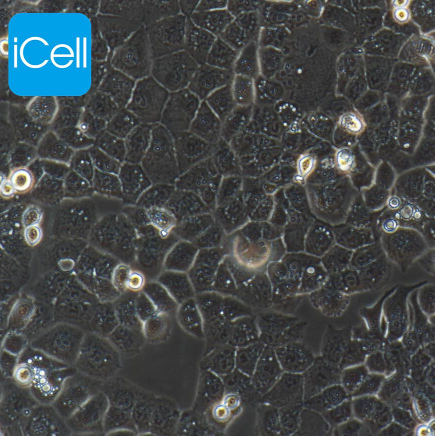 HEC-1-A 人子宫内膜腺癌细胞/STR鉴定/镜像绮点（Cellverse）