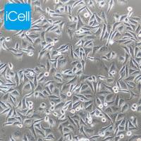 MGC-803/MGC-803细胞/MGC803细胞/MGC803/人胃癌细胞/STR鉴定/镜像绮点(Cellverse)