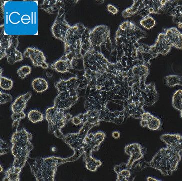 RL95-2 人子宫内膜癌细胞/STR鉴定/镜像绮点（Cellverse）