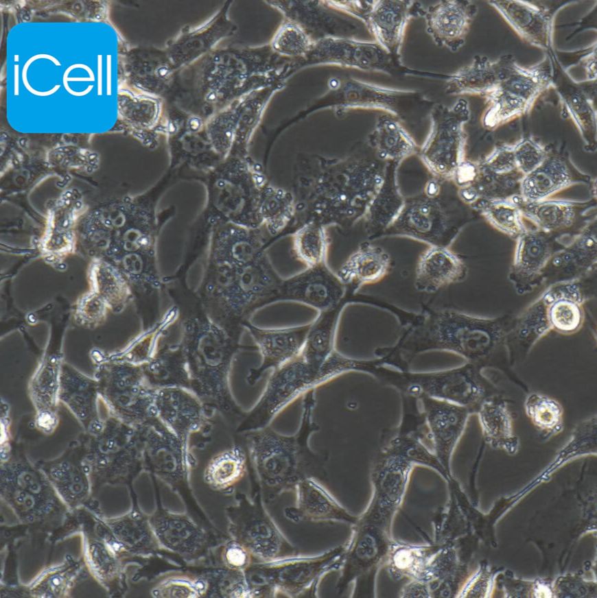 BT-549 人乳腺管癌细胞/STR鉴定/镜像绮点（Cellverse）
