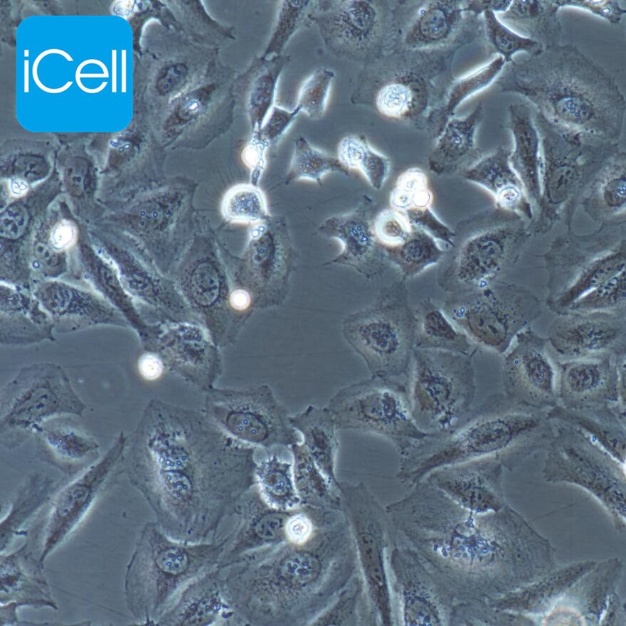 NCI-H446 人小细胞肺癌细胞/STR鉴定/镜像绮点（Cellverse）