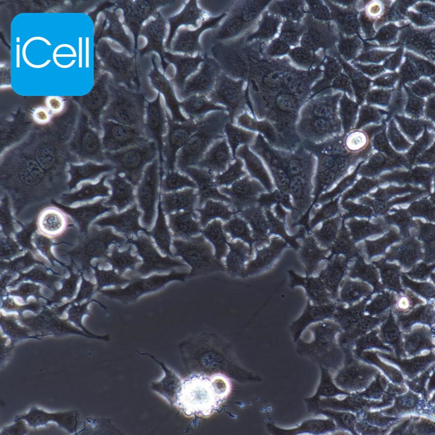 HO-8910PM  人高转移卵巢癌细胞/STR鉴定