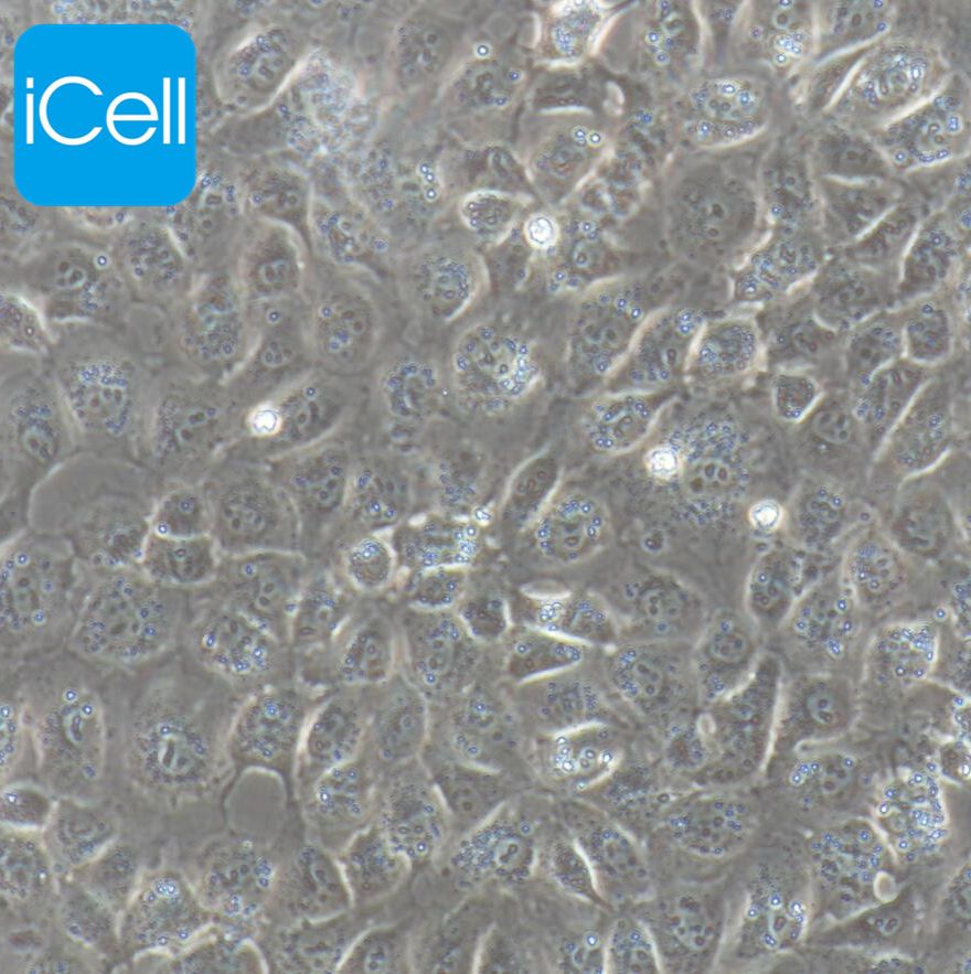 人胰腺成纤维细胞永生化/免疫荧光鉴定/镜像绮点（Cellverse）