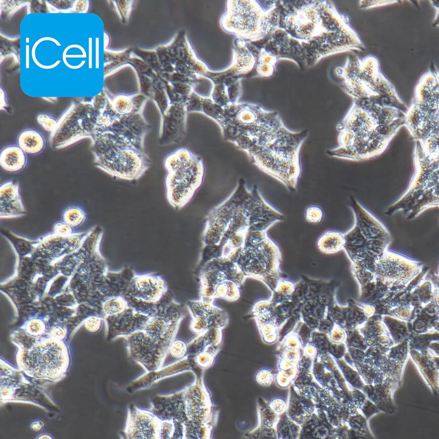 HCT116 人结肠癌细胞/STR鉴定/镜像绮点（Cellverse）