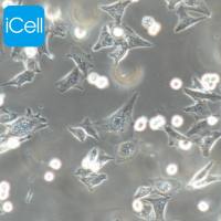 JF-305 | JF-305细胞 | JF305细胞 | JF305 | 人胰腺癌细胞 | STR鉴定 | 镜像绮点(Cellverse)