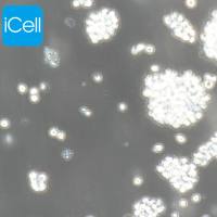 Jurkat |Jurkat细胞|人T淋巴细胞白血病细胞/STR鉴定