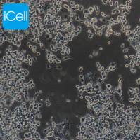 Neuro-2a、Neuro-2a细胞、Neuro2a细胞、Neuro2a、小鼠