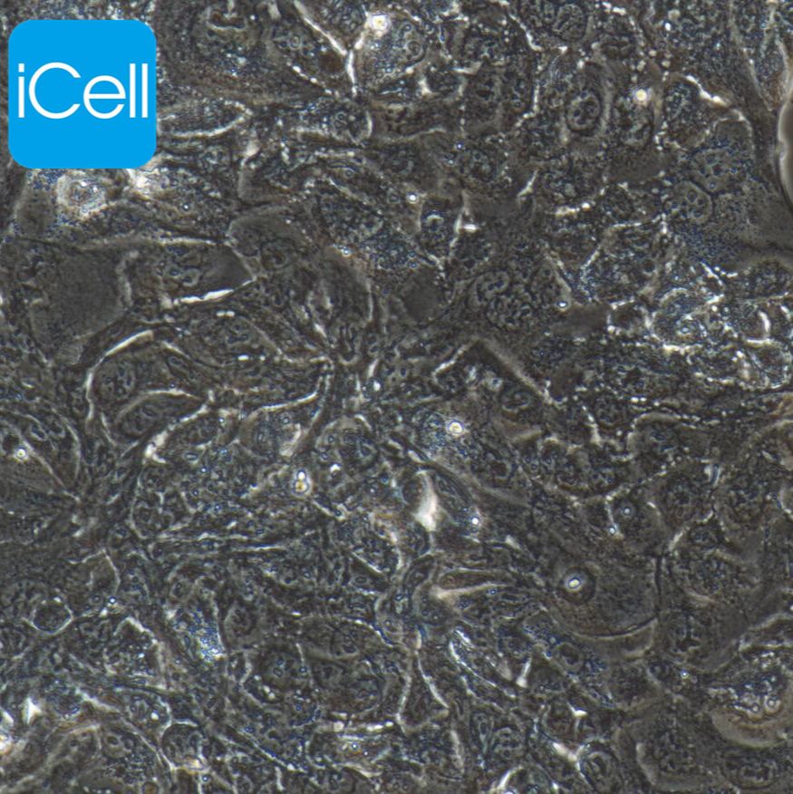 NCI-H441 人肺腺癌细胞/STR鉴定/镜像绮点（Cellverse）