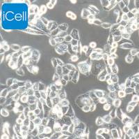 PC-9  |  PC-9细胞  |  PC9细胞  |  PC9  |  PC9人