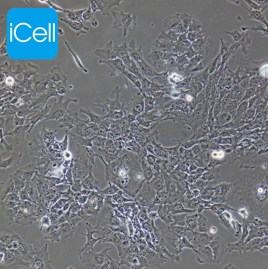 Hs578Bst 人乳腺癌细胞/STR鉴定/镜像绮点(Cellverse)
