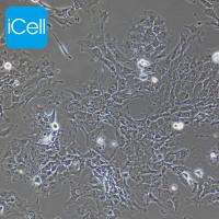 Hs578Bst 人乳腺癌细胞/STR鉴定/镜像绮点(Cellverse)