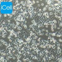 HEC-1-B 人子宫内膜腺癌细胞/STR鉴定